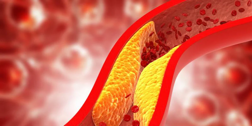 El infarto que has tenido hasta los 50 años podrás prevenirlo a los 20